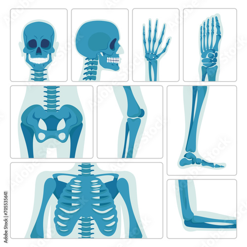 X-ray Pictures Capture Internal Structures Of Skull, Hand, Chest, Leg And Pelvis By Utilizing Penetrating Radiation