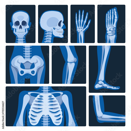 X-ray Pictures Vector Set. Medical Images Produced By Exposing The Body To Xrays, Revealing Internal Structures
