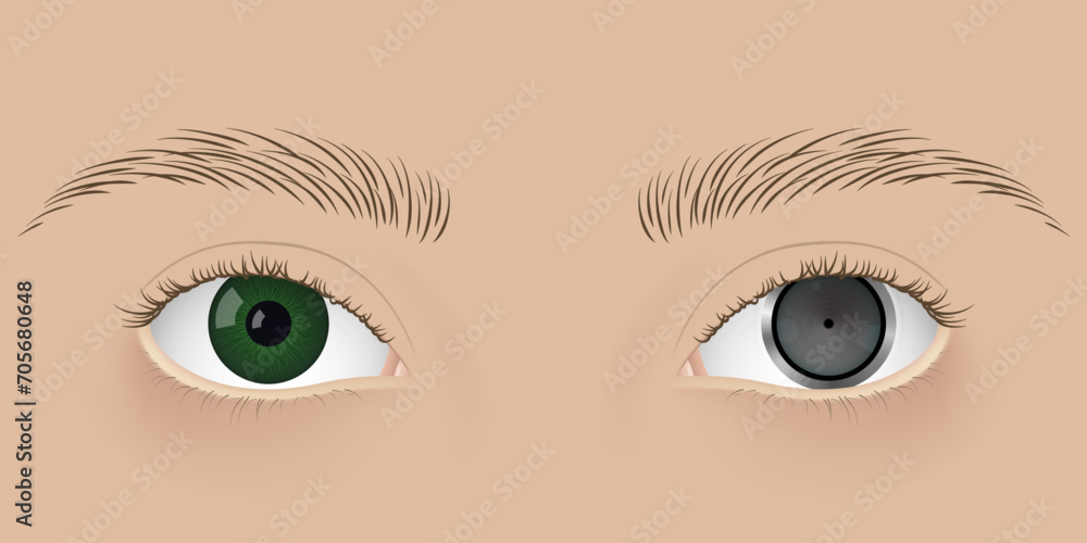 Human cyborg with camera inside one eye. Human cyborg with camera inside one eye.