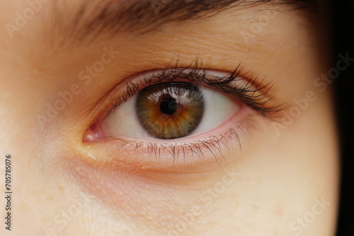 Macro image of a human eye © pathdoc
