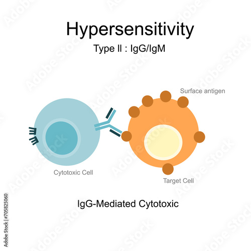 The Hypersensitivity type ll : IgG-mediated or Antibody-Dependent cellular Cytotoxic that represents the reaction between Surface antigen of Target Cells and Cytotoxic cell.  