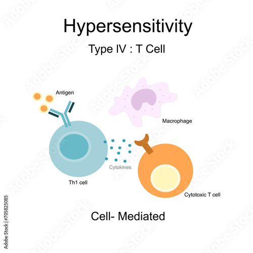 The Hypersensitivity type lV: Cell-mediated that represents the reaction diagram of Th1 cell and Cytotoxic T cell, Macrophage via Cytokine that secreted after binding of antigen and antibody.