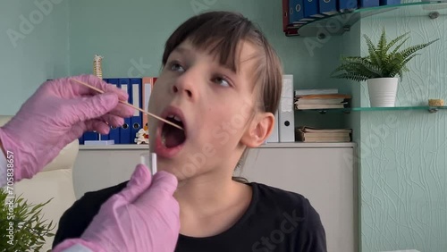 Female pediatrician using swab to take sample from a patient throat photo
