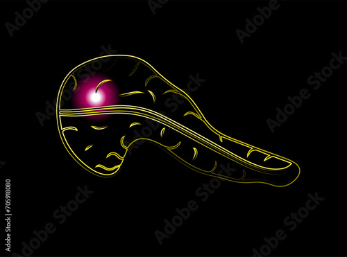 Vector isolated illustration of pancreas with neon effect. Pancreatic pain. Pancreatic cancer.