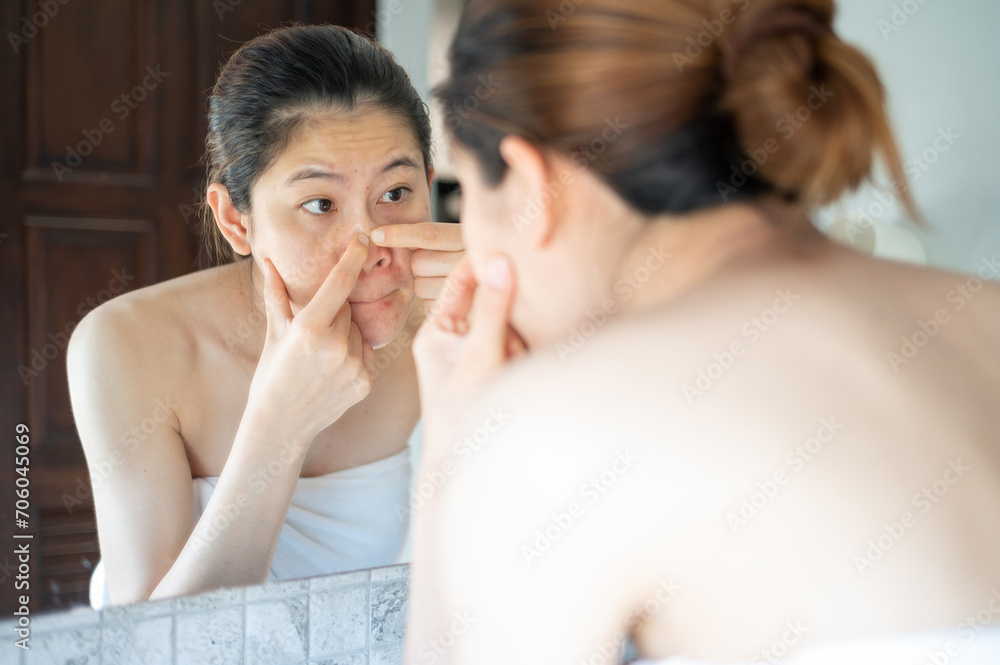 Asian woman trying to squeezing acne. Squeezing pimples it can cause damage and scarring to your skin. Asian woman trying to squeezing acne. Squeezing pimples it can cause damage and scarring to your skin.