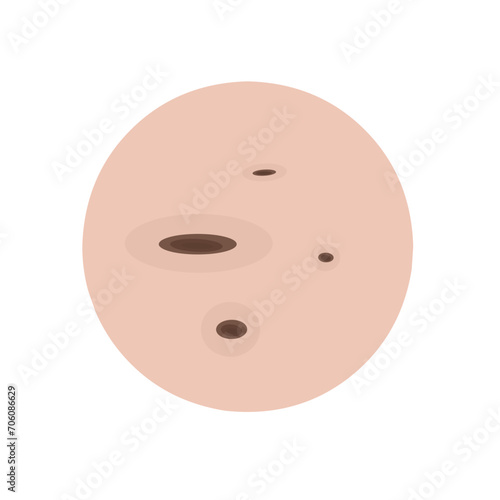 Type of acne infographic 