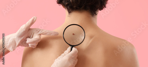 Doctor examining mole of young man on pink background. Concept of skin cancer photo