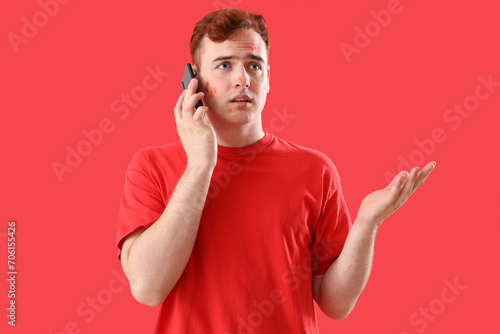 Teenage boy with acne talki...