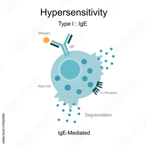 The diagram of Hypersensitivity type l : IgE (Immunoglobulin E) -mediated that represents the reaction between Allergen or antigen, Antibody (IgE) and Degranulation of mast cell.
