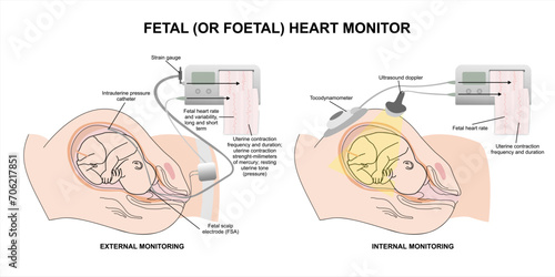 Papier peint Fetal (or foetal) heart monitor medical equipment illustration
