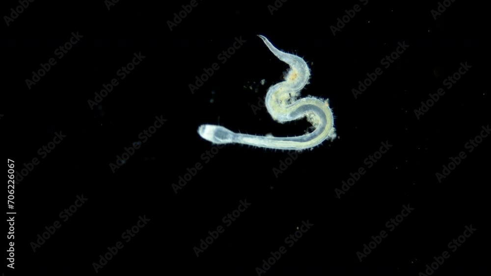 Worm nematoda family Draconematidae under microscope, possibly genus Draconema sp. Sample found in White sea Worm nematoda family Draconematidae under microscope, possibly genus Draconema sp. Sample found in White sea