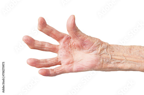 Rheumatoid polyarthritis of the hand of a 95 year old woman isolated on a white background. photo