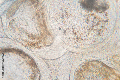 Study of Parasitic helminths (Trematodes) of marine fishes under a microscope. photo