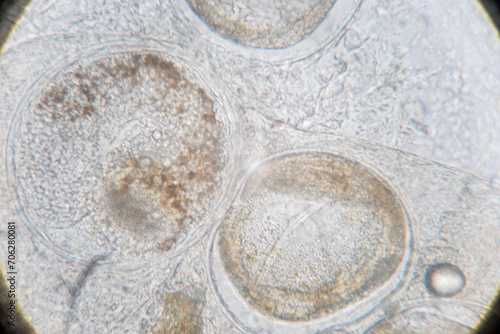 Wallpaper Mural Study of Parasitic helminths (Trematodes) of marine fishes under a microscope. Torontodigital.ca