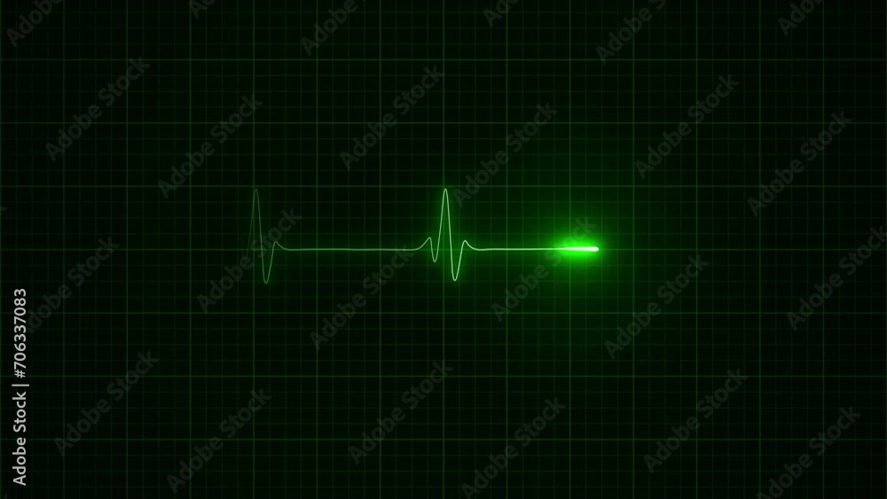 Heart Beat monitor 4k Loop Animation. With five Different Colors. Stock