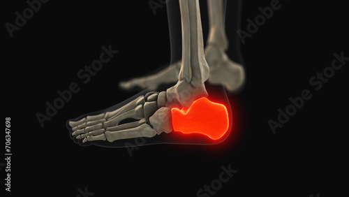 Medical animation of the calcaneus bone pain photo