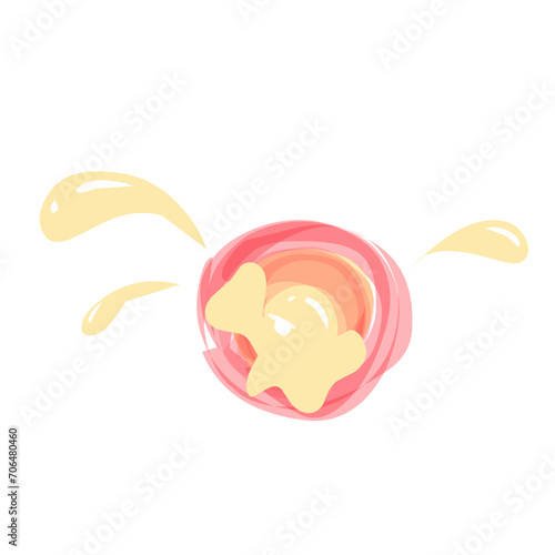 Acne Illustration 