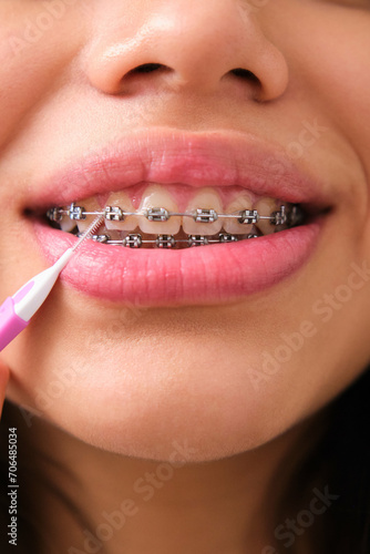 Unrecognizable female teenager cleaning her braces with an interdental brush.