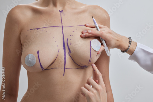 Doctor hand drawing lines on woman breast, breast implant surgery concept. photo