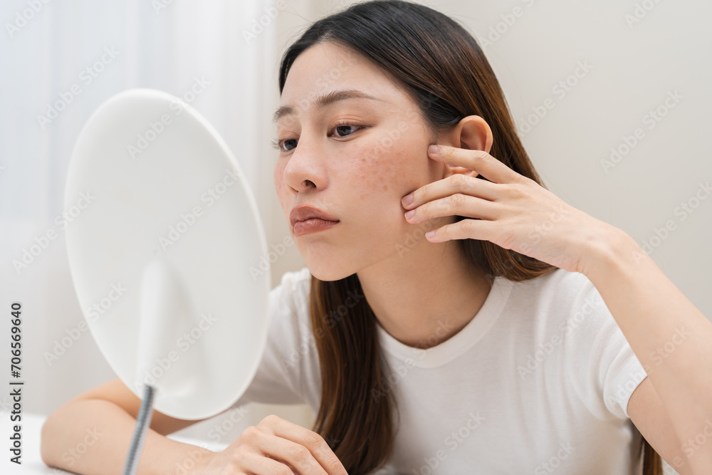 Dermatology, expression face worry asian young woman looking mirror hand touch face at dark spot of melasma, freckle from pigment melanin, allergy sun. Beauty care, skin problem treatment, acne care. Dermatology, expression face worry asian young woman looking mirror hand touch face at dark spot of melasma, freckle from pigment melanin, allergy sun. Beauty care, skin problem treatment, acne care.