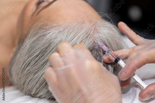 Close up of woman having hair treatment injections