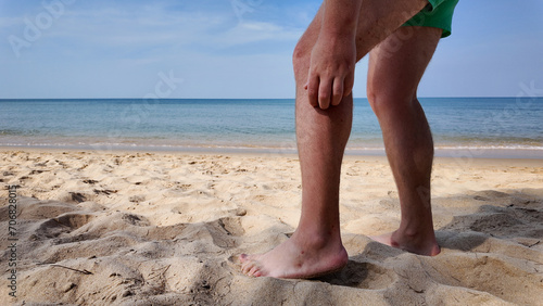 Close-up of a person's bare legs and feet standing on a sandy beach, beach fly bites, beach flea bites, with the ocean in the background, evoking a sense of summer vacations © fotoworld