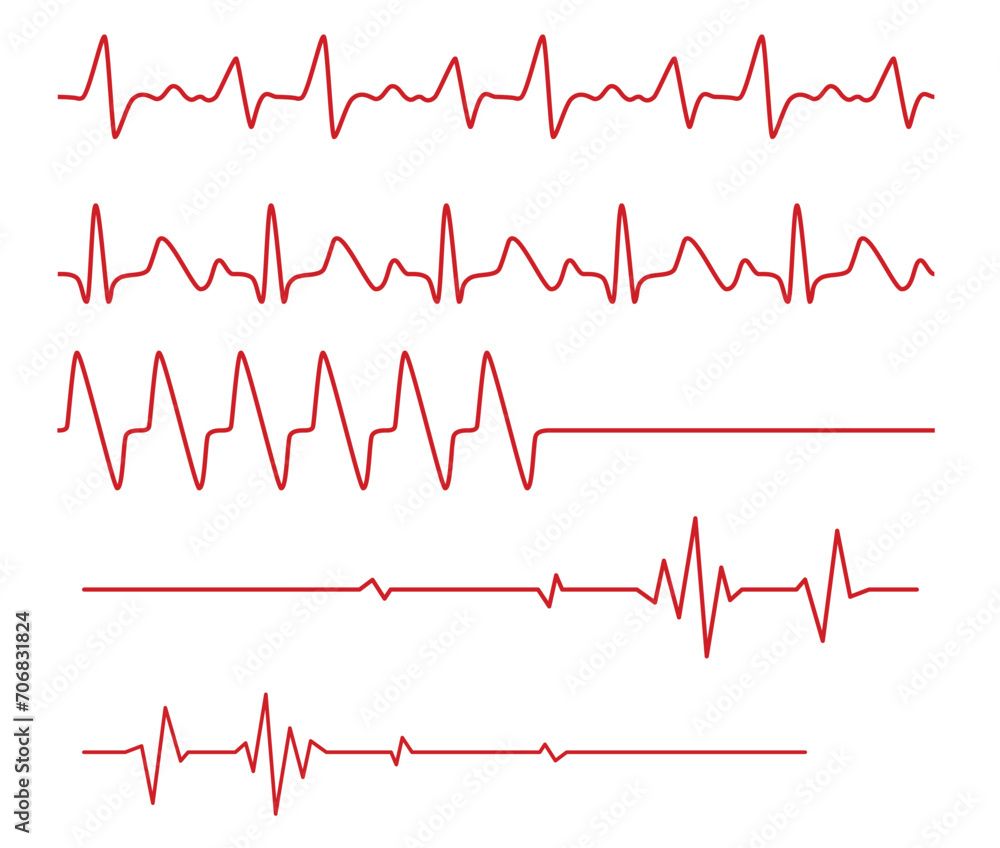 Creative set of vector illustration of heart line cardiograms isolated on background.