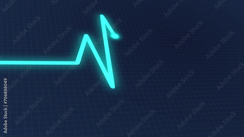 Vidéo Stock ECG cardiogram oscilloscope monitor heartbeat line shows heart rate on black