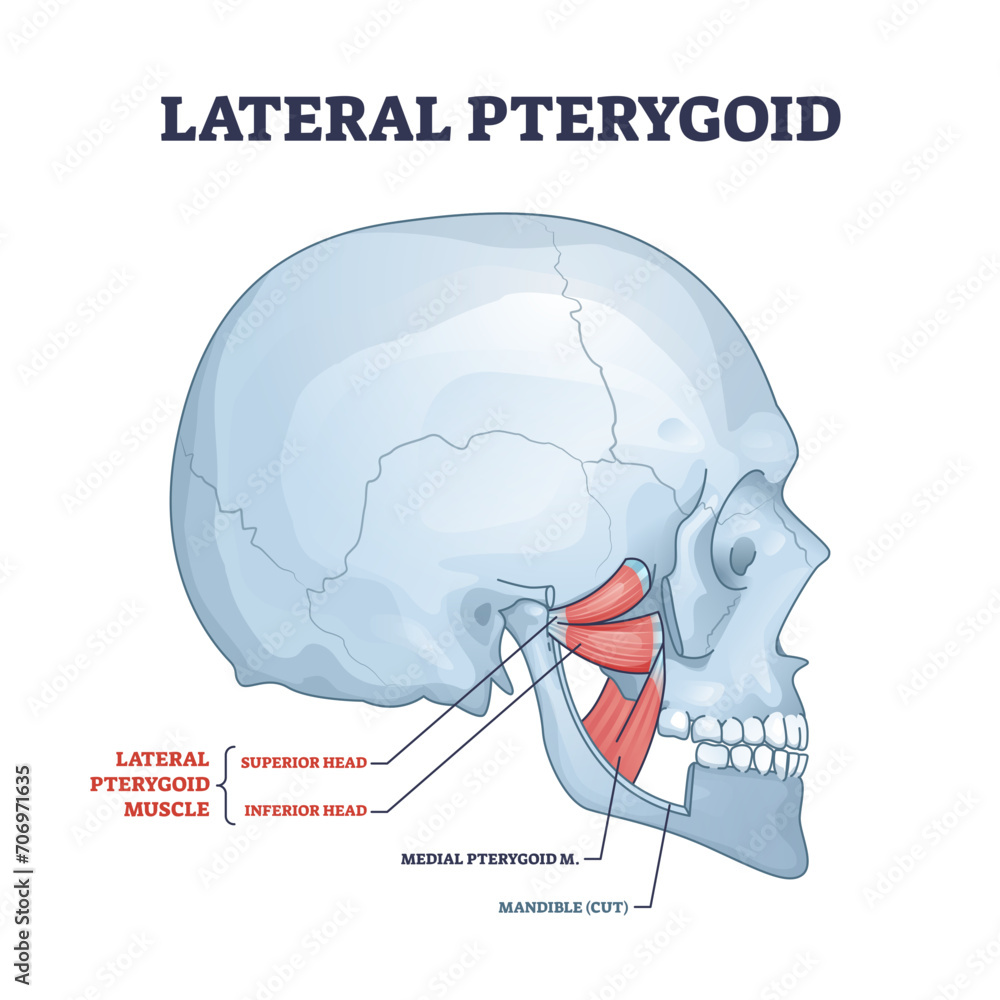 Lateral pterygoid muscle with superior and inferior head outline ...