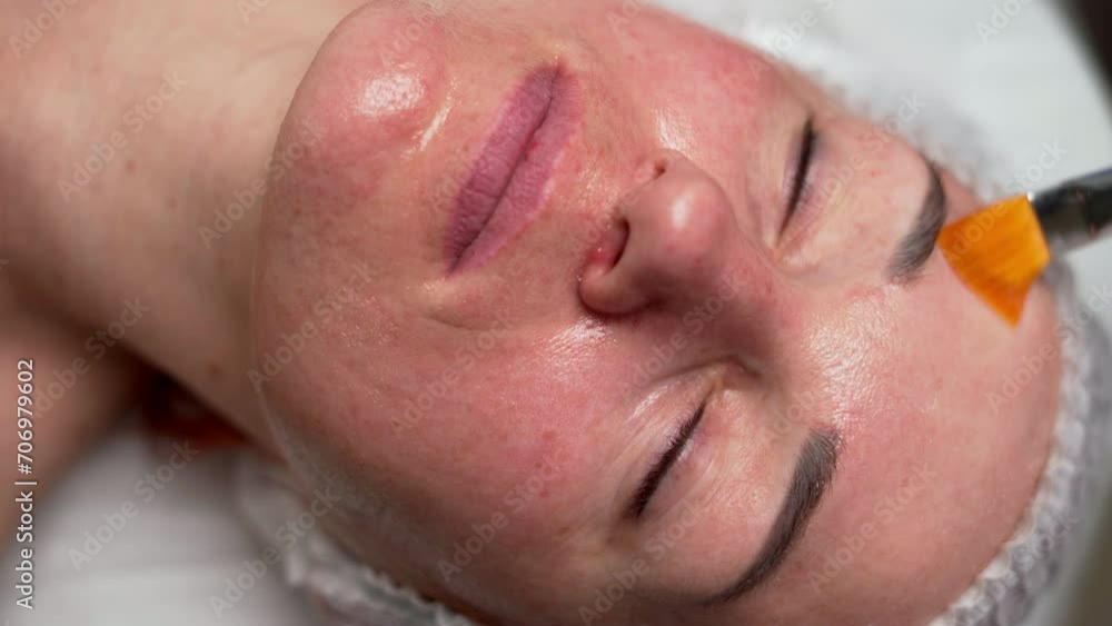 Close-up beautician doctor apply peeling acid female client at beauty clinic. Cosmetologist doing skincare treatment. Concept Health care therapy Close-up beautician doctor apply peeling acid female client at beauty clinic. Cosmetologist doing skincare treatment. Concept Health care therapy