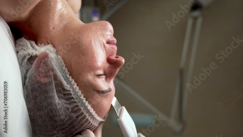 Cosmetologist working with woman's face while procedure ultrasound cavitation, facial peeling photo