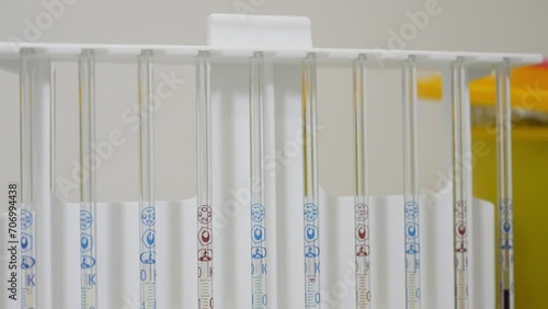 Blood in test tubes in laboratory