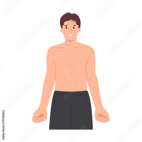 Illustration of a man with measles, red rash, itchy skin, skin disease concept. Flat design.