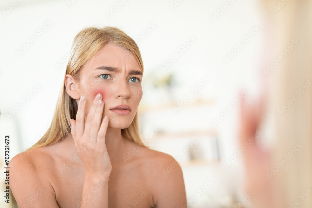 lady touching cheek unhappy about acne and skin imperfections indoors lady touching cheek unhappy about acne and skin imperfections indoors