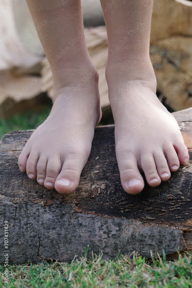 Φωτογραφία Child feet on wood log, barefoot little girl on tree trunk, countryside lifestyl