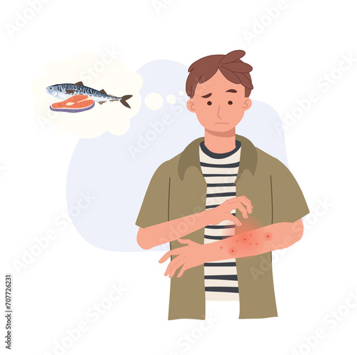 seafood Allergy Reaction. man with Itchy Red Rash on Arm. Allergic Skin Problem from fish.