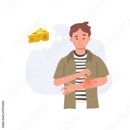 lactose Allergy Reaction. man with Itchy Red Rash on Arm. Allergic Skin Problem from cheese