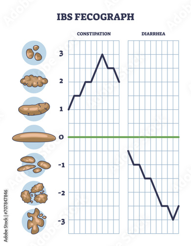 IBS fecograph as daily bristol stool form representation outline diagram. Labeled educational scheme with constipation or diarrhea diagnosis from patient excrement classification vector illustration.