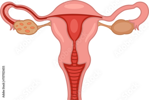 Female Reproductive System. Vector Illustration of Healthy Female Reproductive Organs. Human Anatomy photo