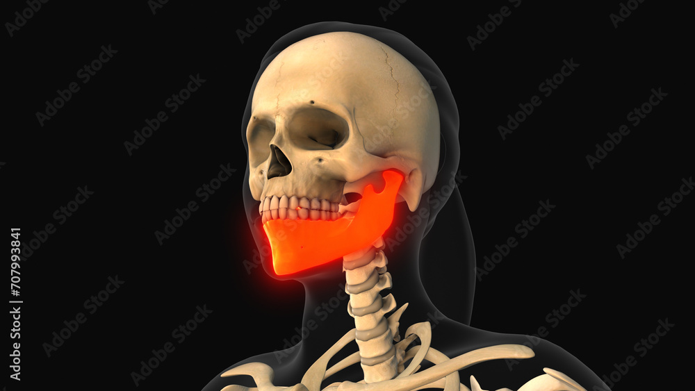 Αυτοκόλλητο Medical animation of the mandible bone pain
