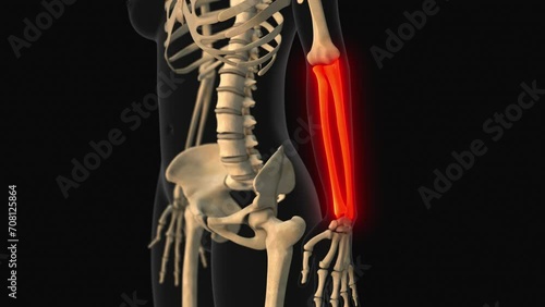 Medical animation of the ulna radius bone pain