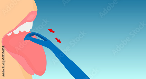 Tongue scraper, personalized oral hygiene instrument. Clean mouth home. Open female mouth with teeth and tongue and a scraper, tongue brush, on a blue gradient background. Copy space.