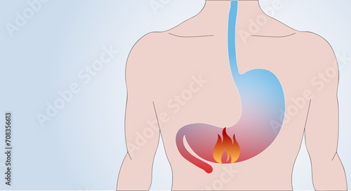 Medical examination. examination of the stomach, intestines, digestive problems, gastritis. Copy space.