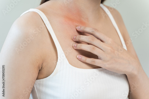 Sensitive skin allergic concept, Woman itching on her chest have a red rash from allergy symptom and from scratching. photo