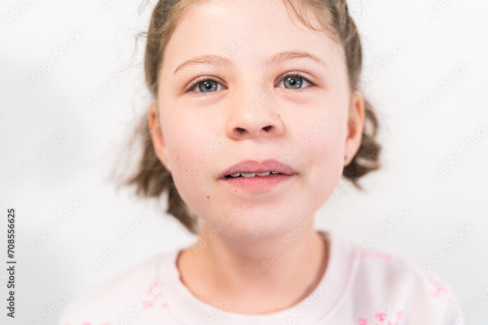 Little girl with rainbow braces Little girl with rainbow braces