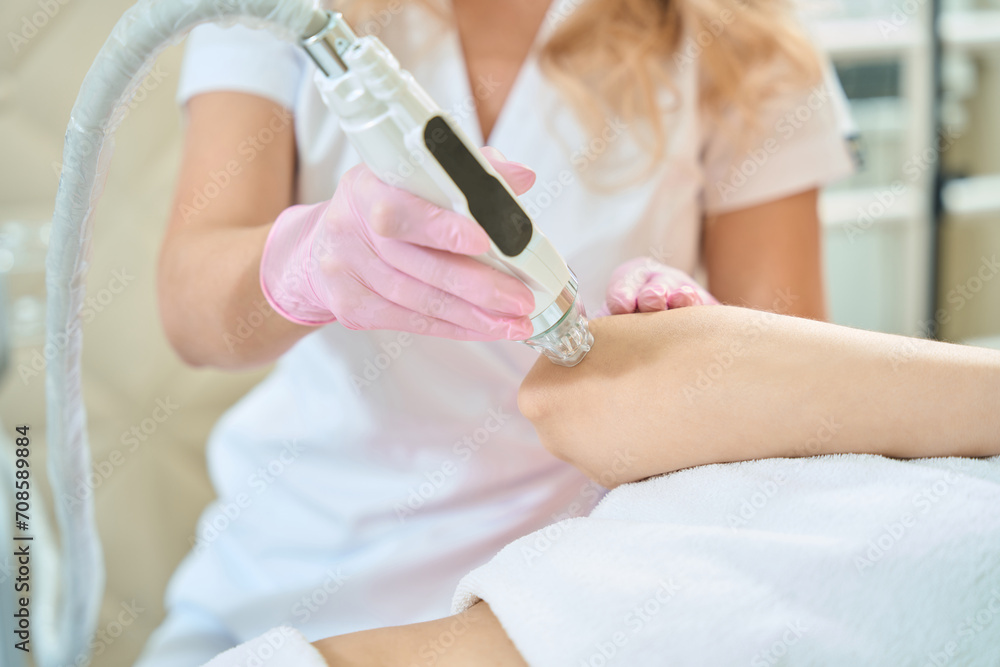 Partial of female cosmetologist doing microneedle rf lifting of woman elbow skin Partial of female cosmetologist doing microneedle rf lifting of woman elbow skin
