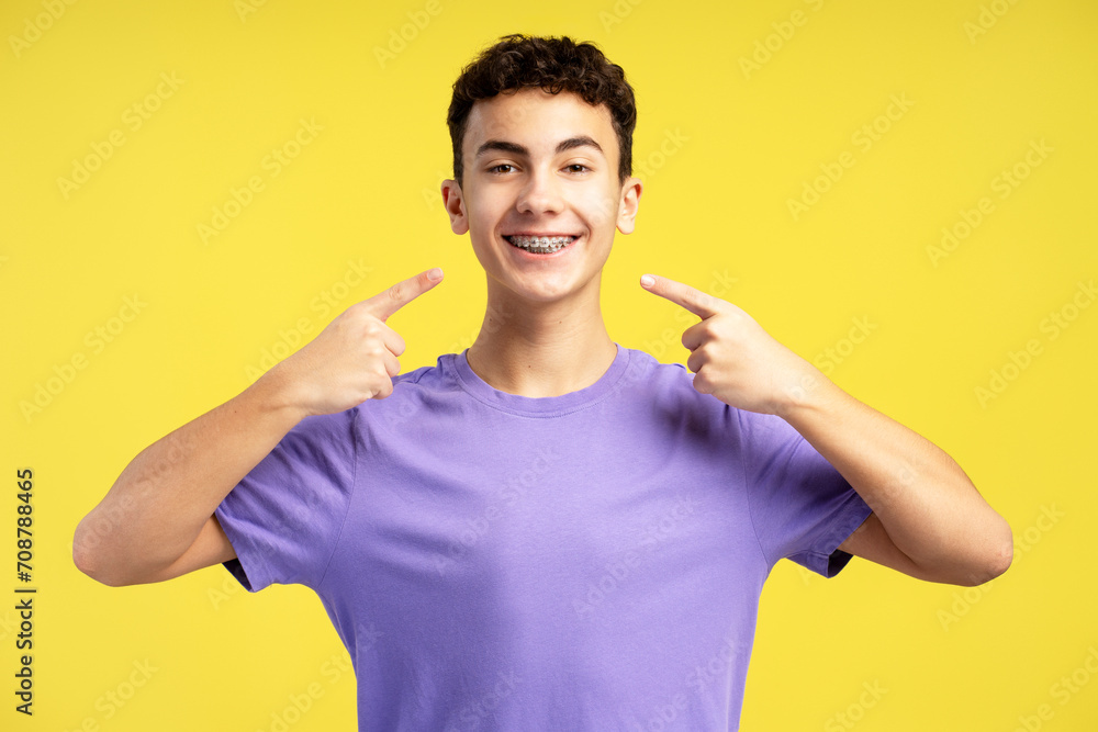 Portrait of positive boy wearing casual t shirt looking at camera pointing fingers at dental braces Portrait of positive boy wearing casual t shirt looking at camera pointing fingers at dental braces