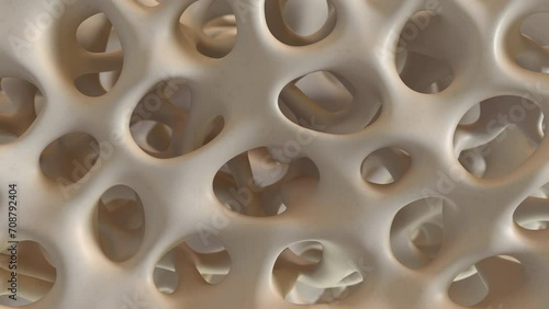 4k rendering of healthy bone structure change to osteoporosis(Close up)
 photo