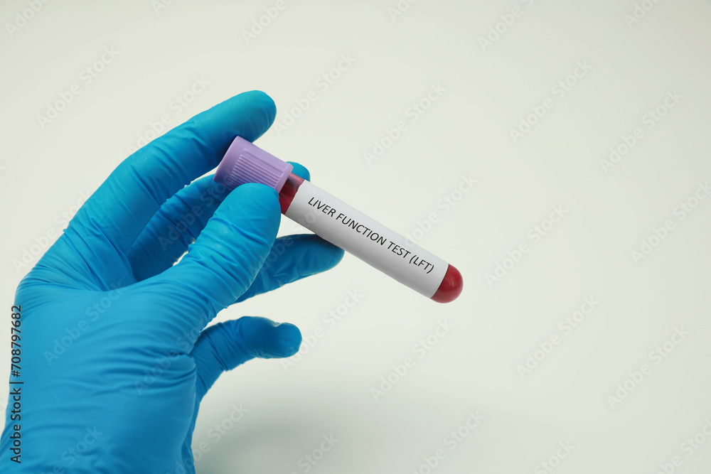 Obraz premium Laboratory worker holding tube with blood sample and label Liver Function Test against white background, closeup. Space for text