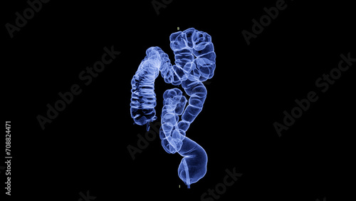 CT colonography , This imaging technique is often employed for colorectal cancer screening, providing detailed images of the colon's interior 3D rendering.